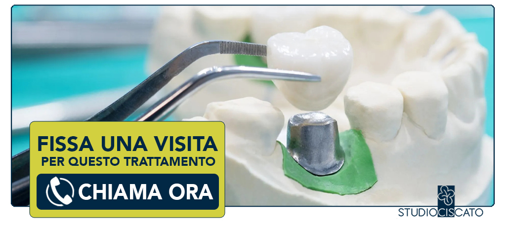 corona-dentale-su-moncone-naturale-e-artificiale Verona