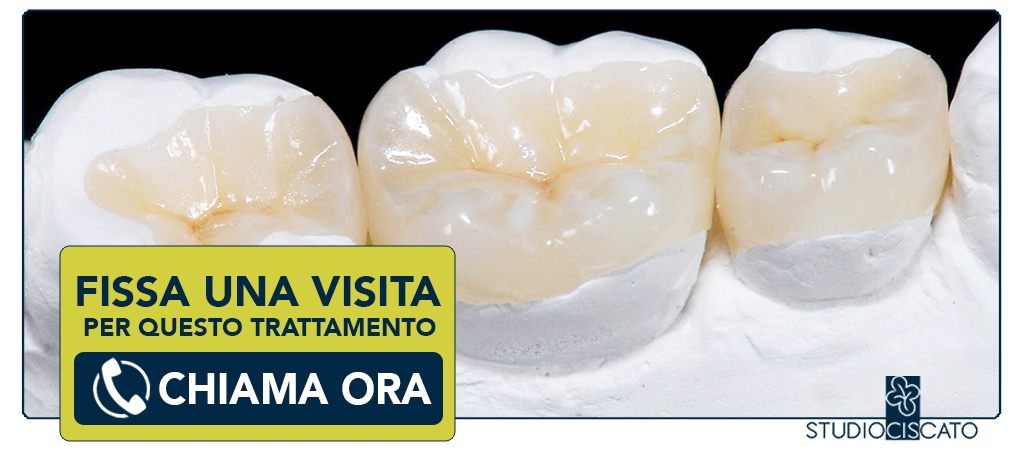 intarsio-dentale Verona